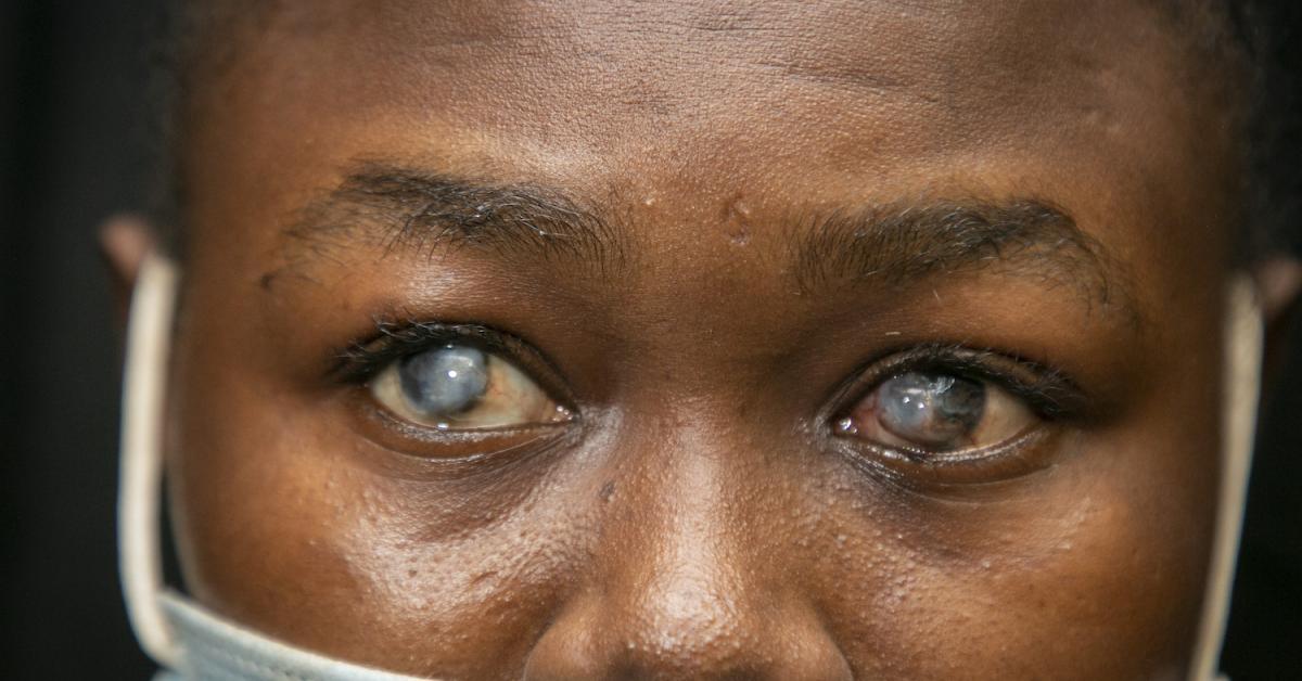Blindness Prevention Programme: Article on Major Causes of Blindness